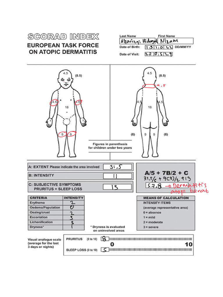 Skor SCORAD pada Dermatitis Atopik | PDF