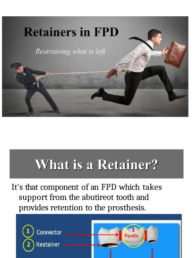 Retainers in Fixed Partial Dentures | PDF | Dentistry Branches | Dentistry