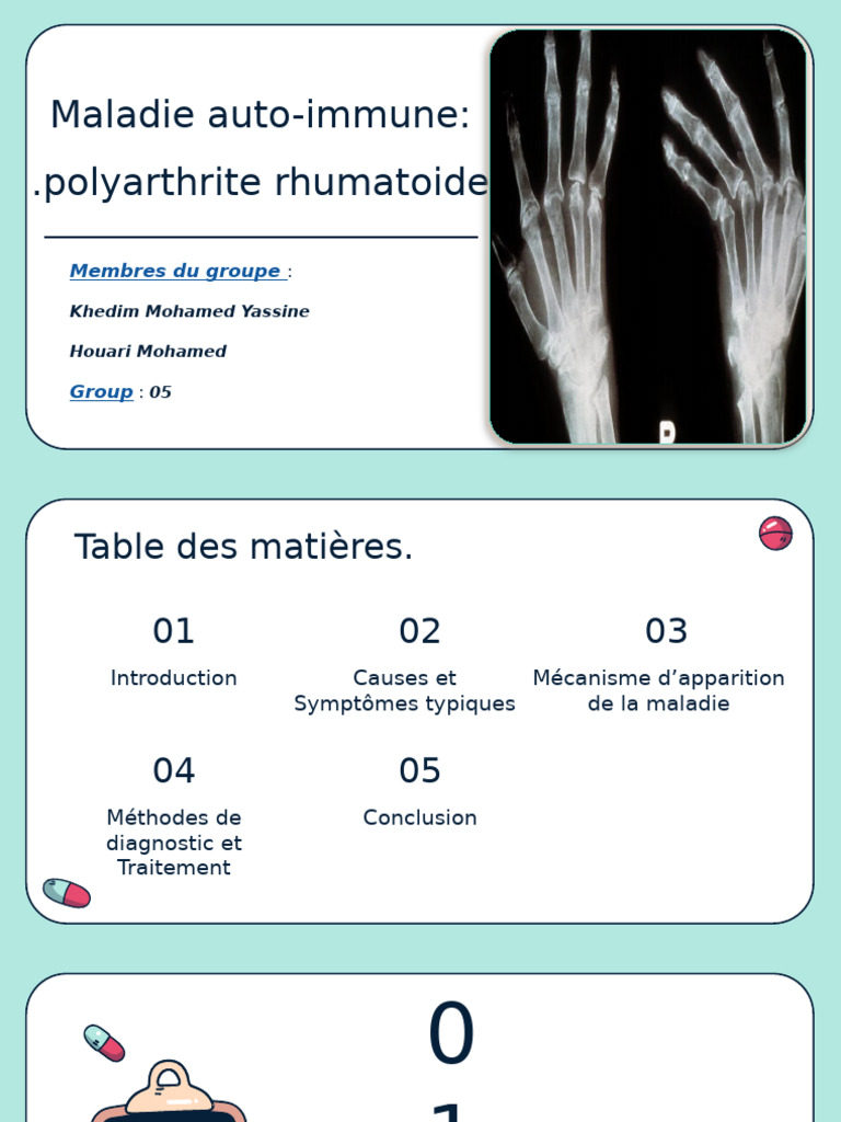 Polyarthrite rhumatoide | PDF | Polyarthrite rhumatoïde | Lymphocyte