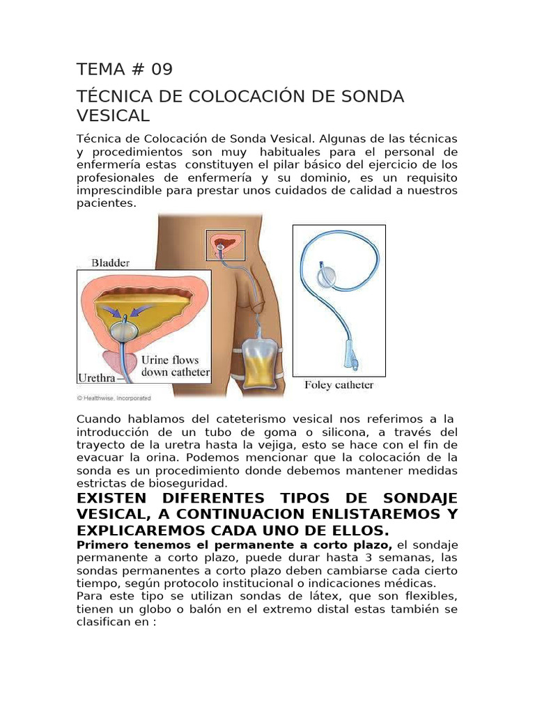 Sonda Foley: Para Qué Sirve, Colocación, Cuidados, Tipos – AUHG