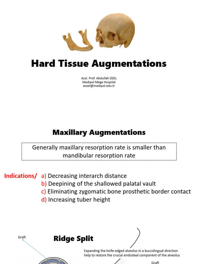 Hard Tissue Augmentation Techniques | PDF
