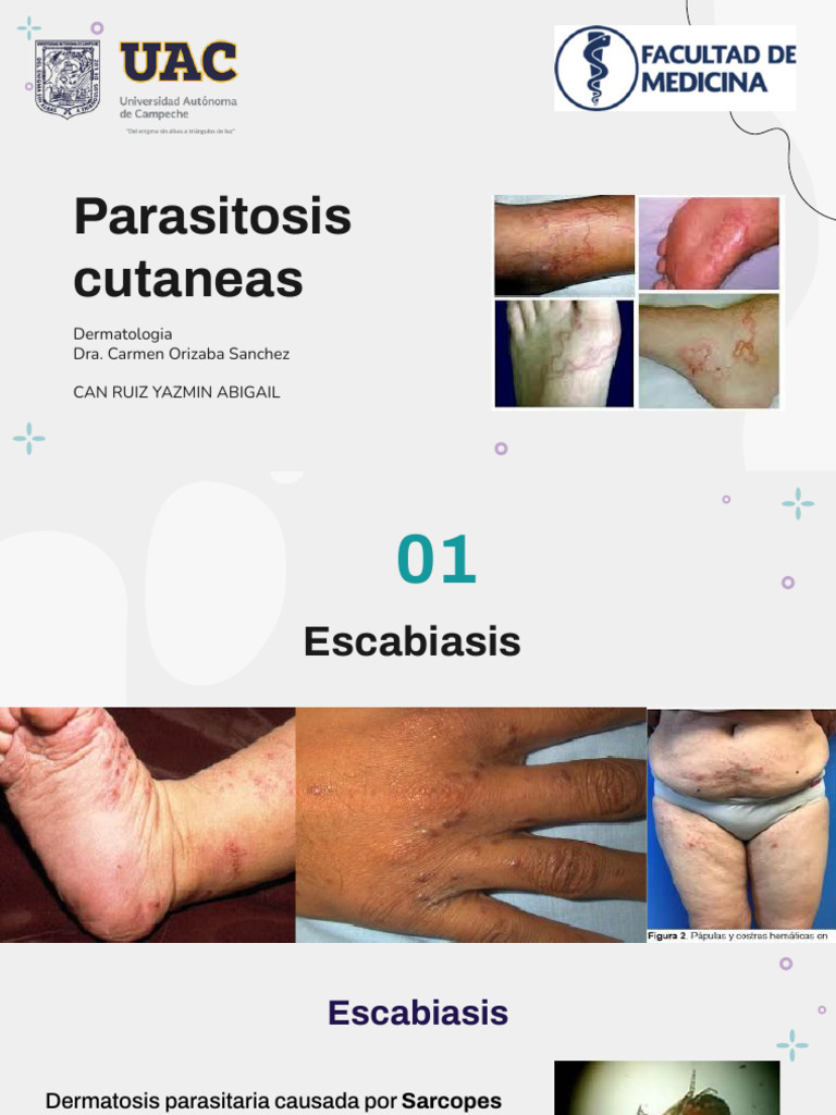 Guía sobre parasitosis cutáneas en dermatología | PDF | Especialidades ...