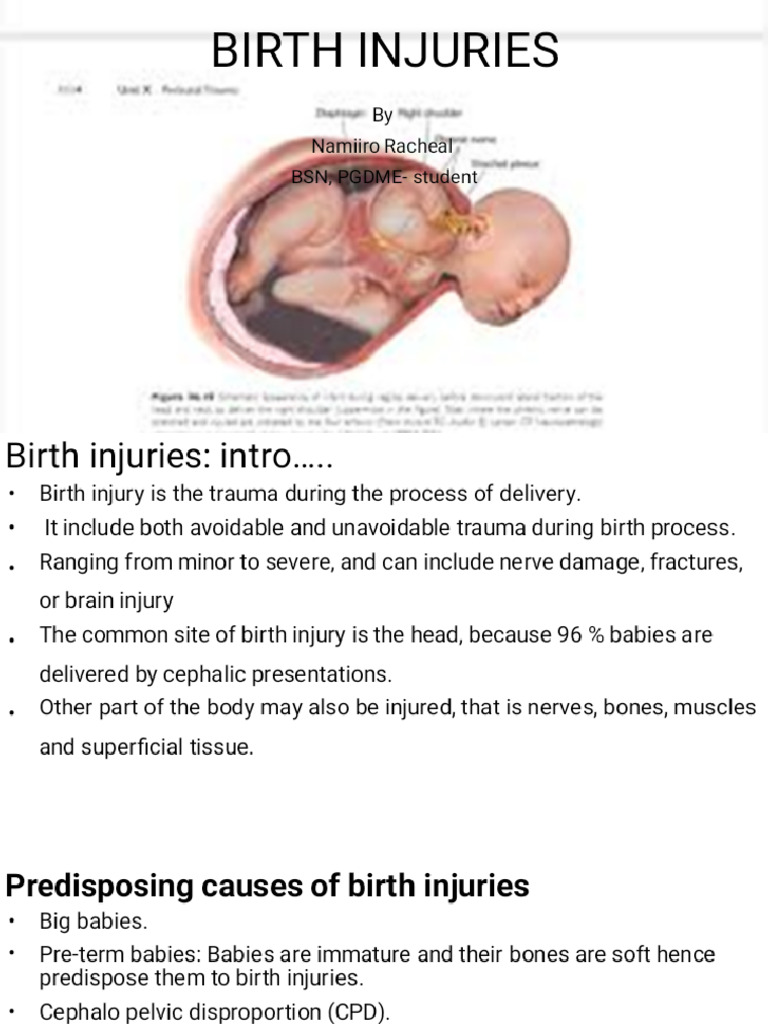 Birth Injuries Phoenix | PDF