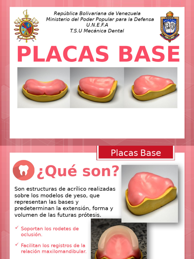 Tipos y características de placas base dental | PDF | Polimetacrilato ...