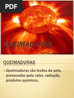 AULA+SENAC+QUEIMADURA
