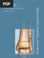 TightRope ABS Button System Overview | PDF | Limbs (Anatomy ...