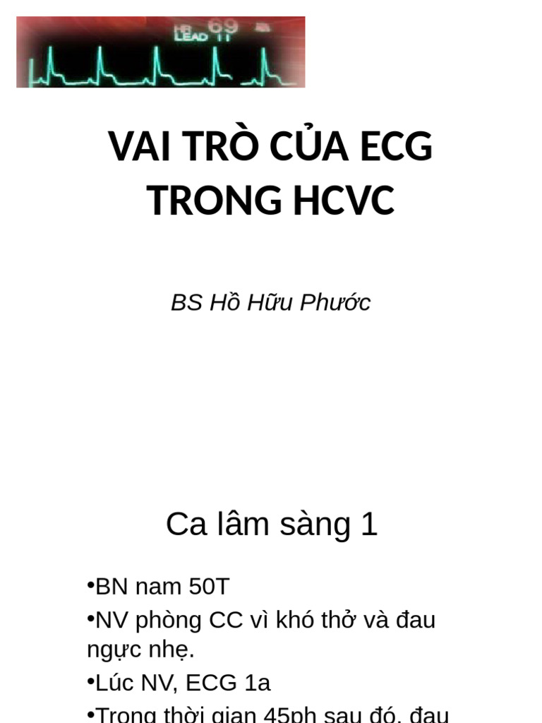 Vai Trò C A Ecg Trong HCVC | PDF
