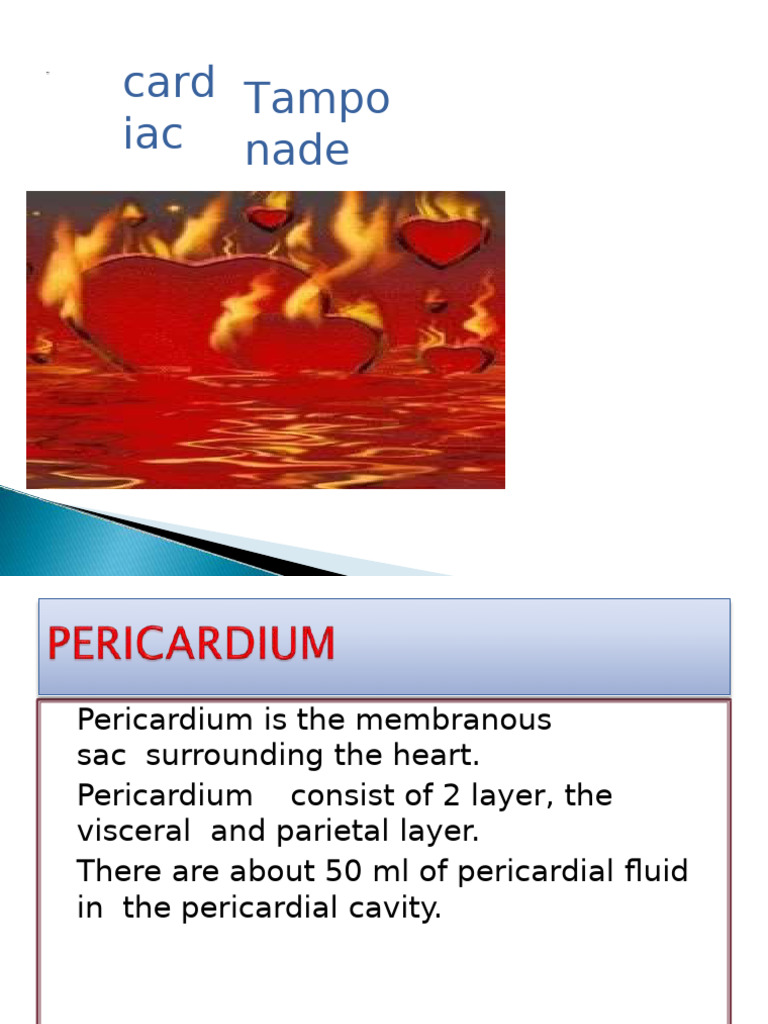 Cardiac Tamponade | PDF | Heart | Cardiovascular System
