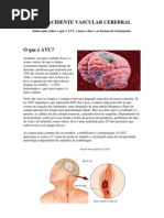 Avc - Acidente Vascular Celebral