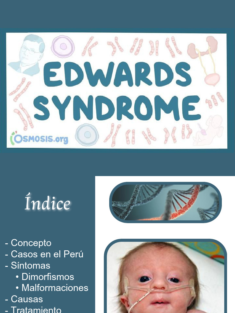 Síndrome de Edwards: Causas y Tratamiento | PDF | Especialidades ...