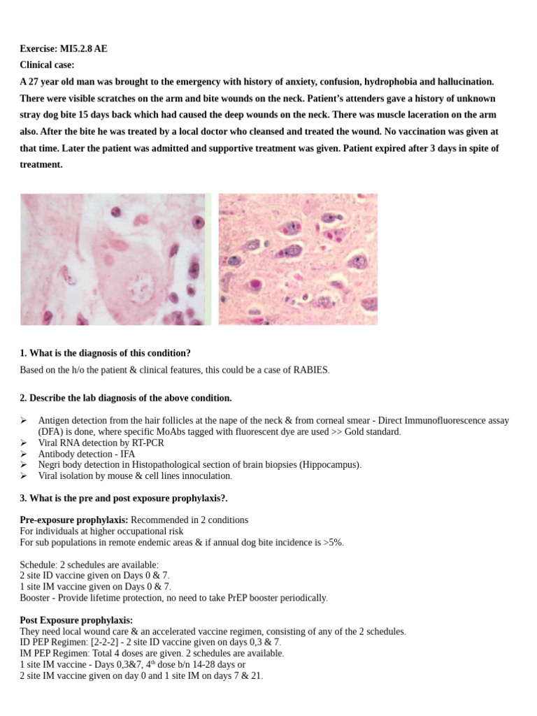Rabies Diagnosis and Vaccination Protocols | PDF | Vaccines | Rabies