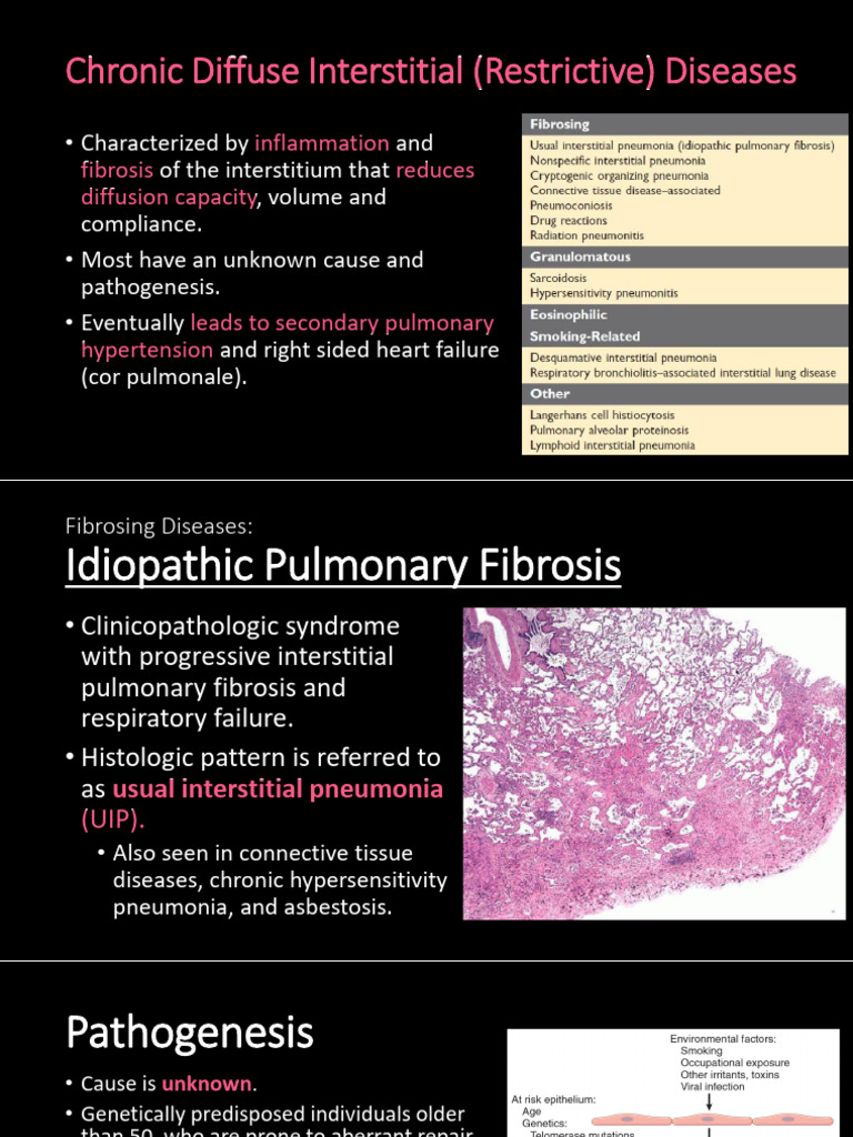 Chronic Diffuse Interstitial Lung Diseases | PDF | Lung | Embolism