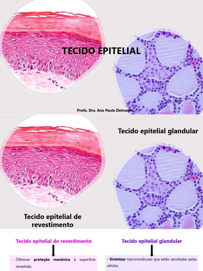 Classificação do Tecido Epitelial | PDF | Epitélio | Tecido conjuntivo