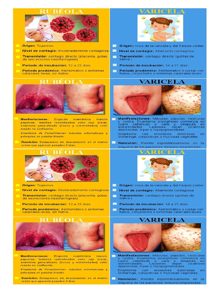Rubeola | PDF