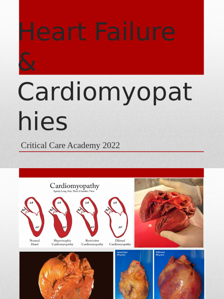 5.heart Failure & Cardiomyopathy | PDF | Heart Failure | Heart