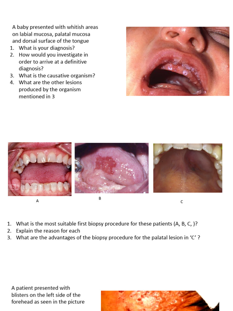 Oral Lesions Diagnosis and Investigation Guide | PDF