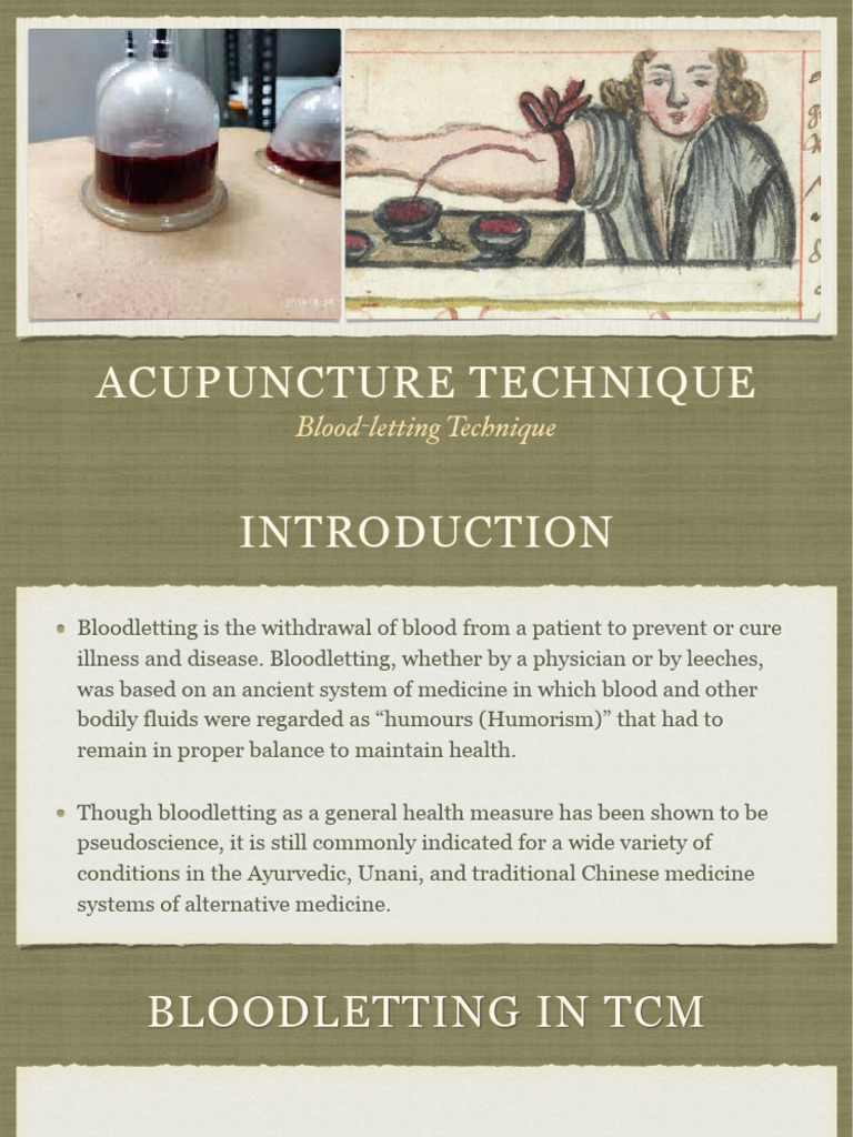 TCM Bloodletting Techniques Explained | PDF | Acupuncture | Medical ...