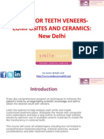 Anterior Teeth Veneers Composites and Ceramics