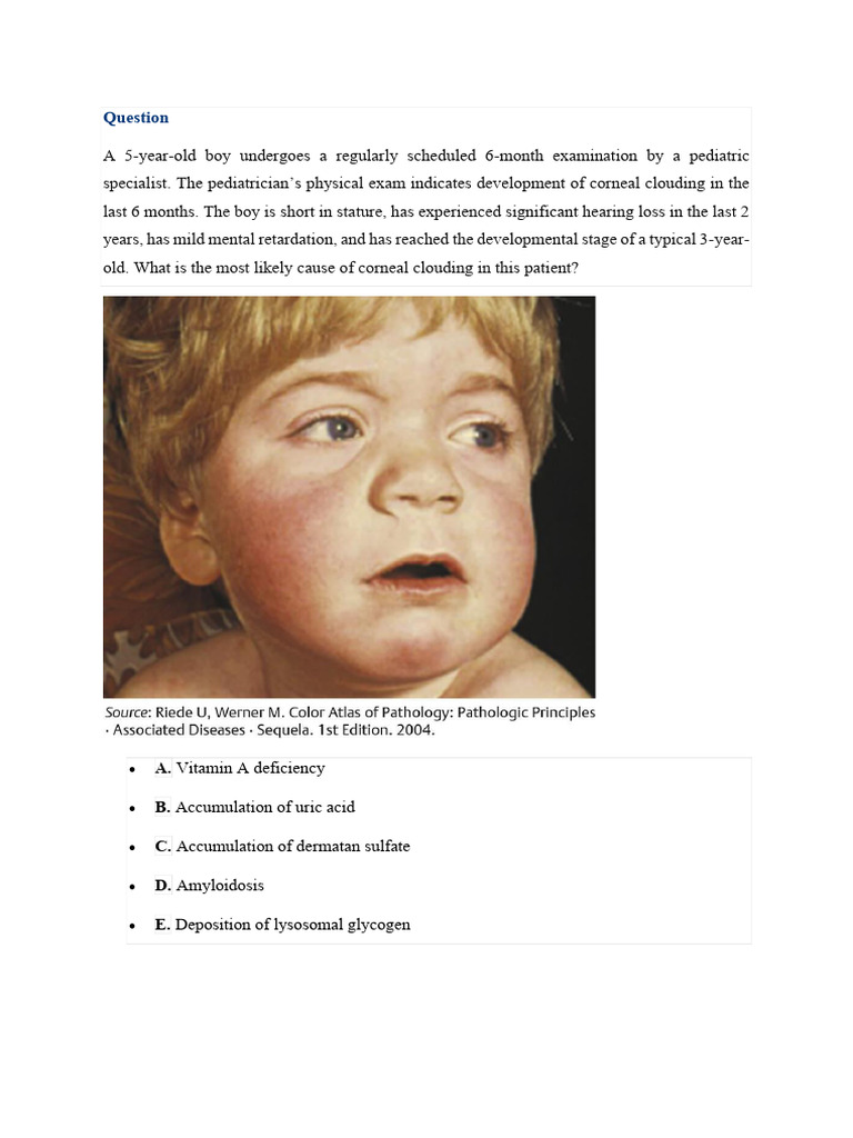 Corneal Clouding in Pediatric Patient | PDF