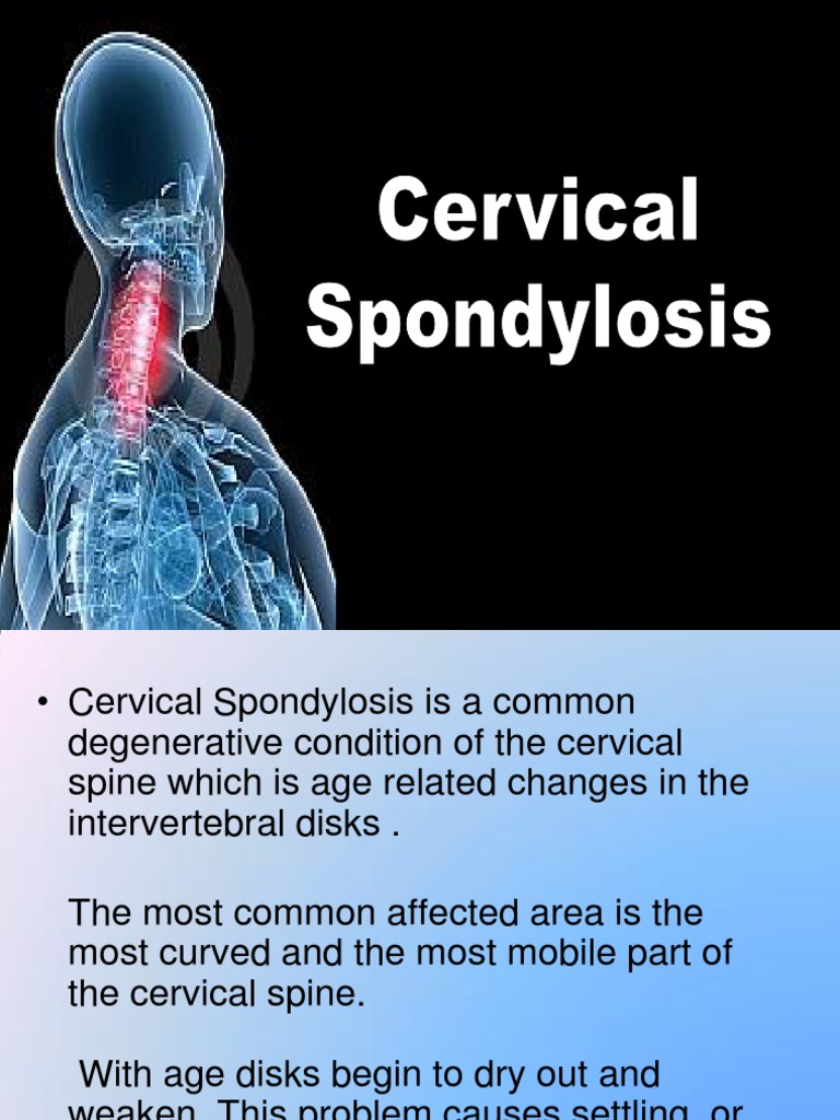 Cervical Spondylosis PDF Neck Relaxation (Psychology)
