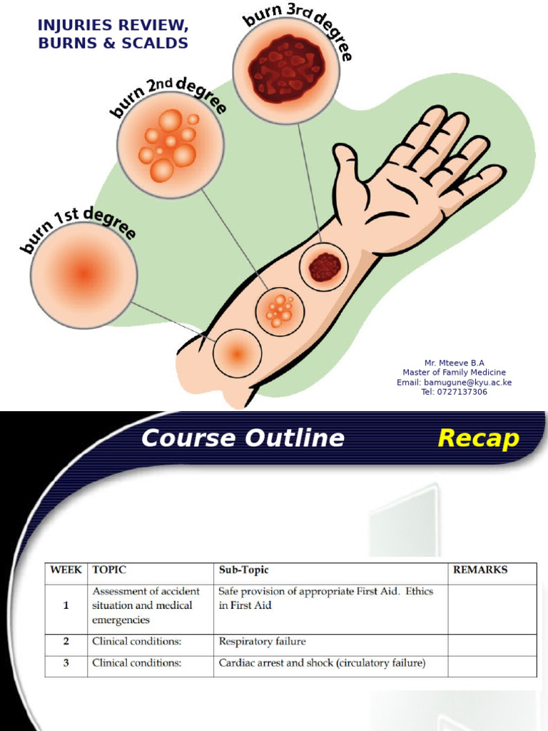 BLS Week 8 9 Content Injuries Review, Dislocation, Burns Scalds - 04th ...
