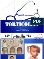 TORTICOLLIS