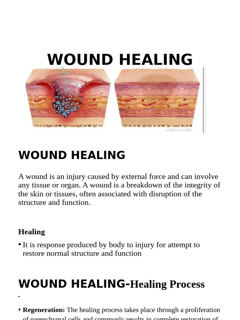 Comprehensive Guide to Wound Healing | PDF | Wound Healing | Healing