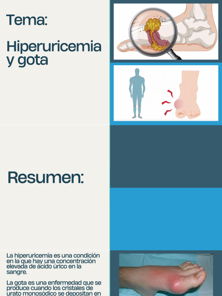 Hiperuricemia y sus complicaciones renales | PDF