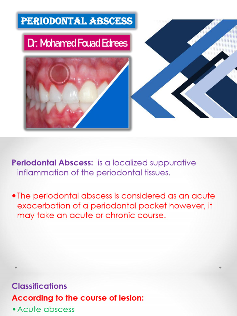 Understanding Periodontal Abscesses | PDF | Periodontology | Inflammation