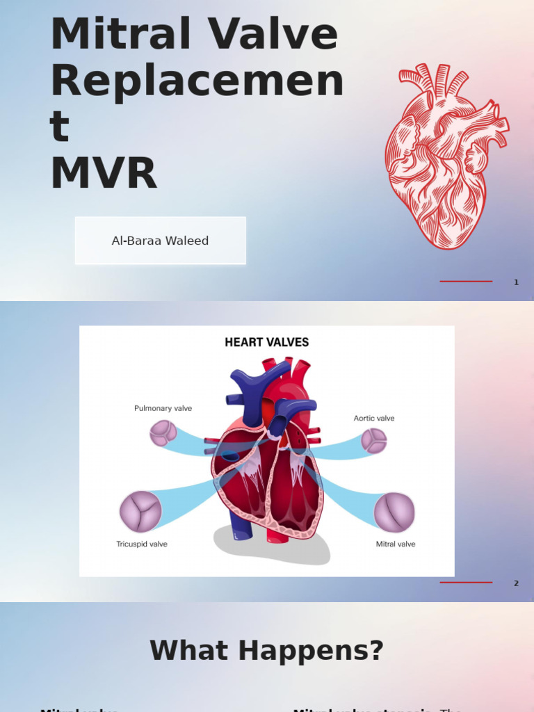 Mitral Valve Replacement Overview | PDF | Heart Valve | Heart