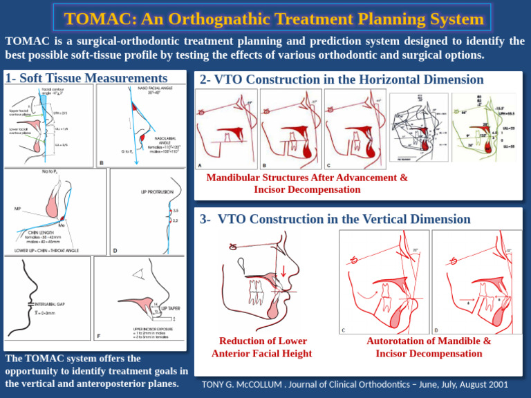 TOMAC: VTO in Orthodontic Planning | PDF
