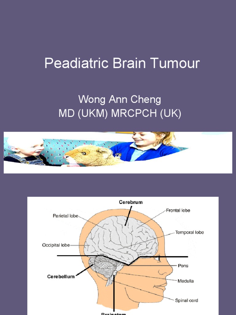 Pediatric Brain Tumor Overview | PDF | Brain Tumor | Glioma