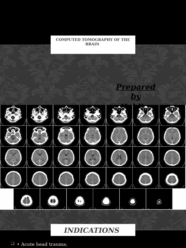 CT Brain Scan Indications and Techniques | PDF | Ct Scan | Neurological ...