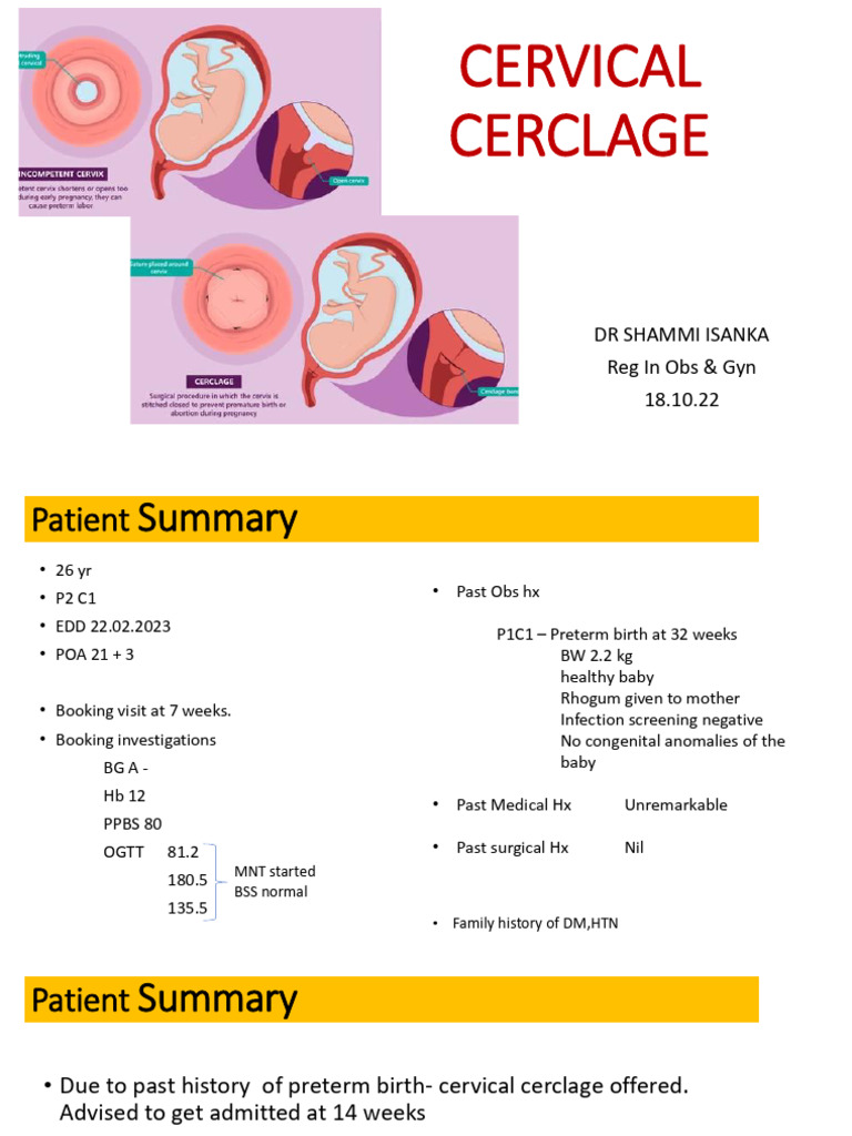 Cervical Cerclage | PDF | Preterm Birth | Childbirth