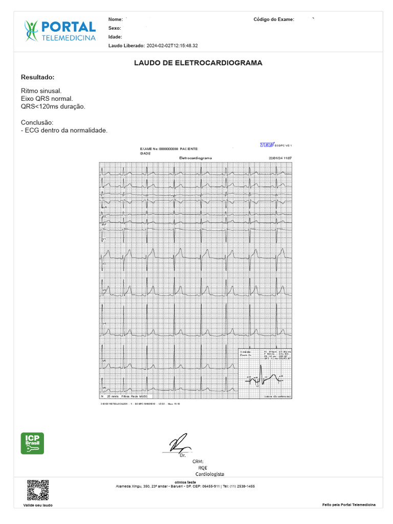Laudo de Eletrocardiograma Normal | PDF