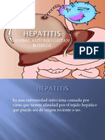 Hepatitis Anibal