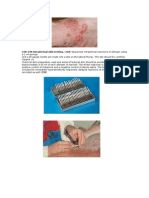 Poze Psoriazis Caine