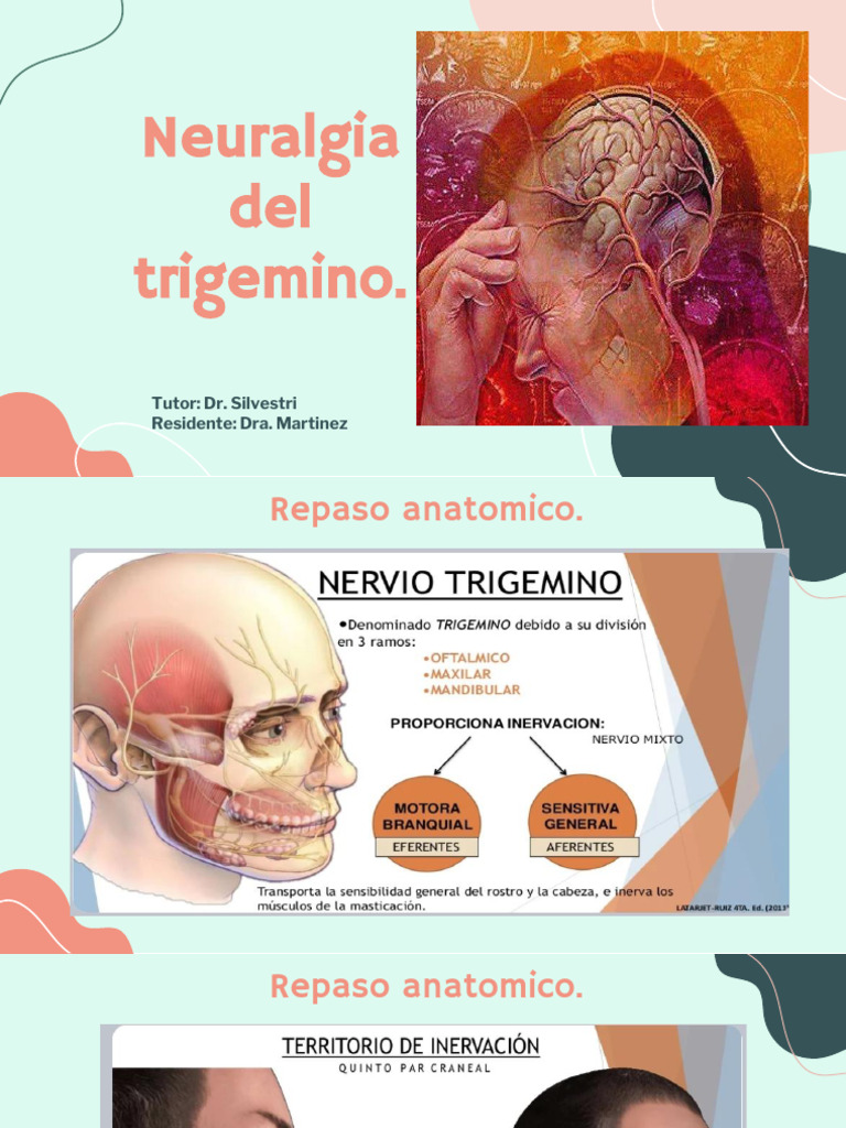 Neuralgia del Trigémino: Diagnóstico y Tratamiento | PDF | Diagnostico
