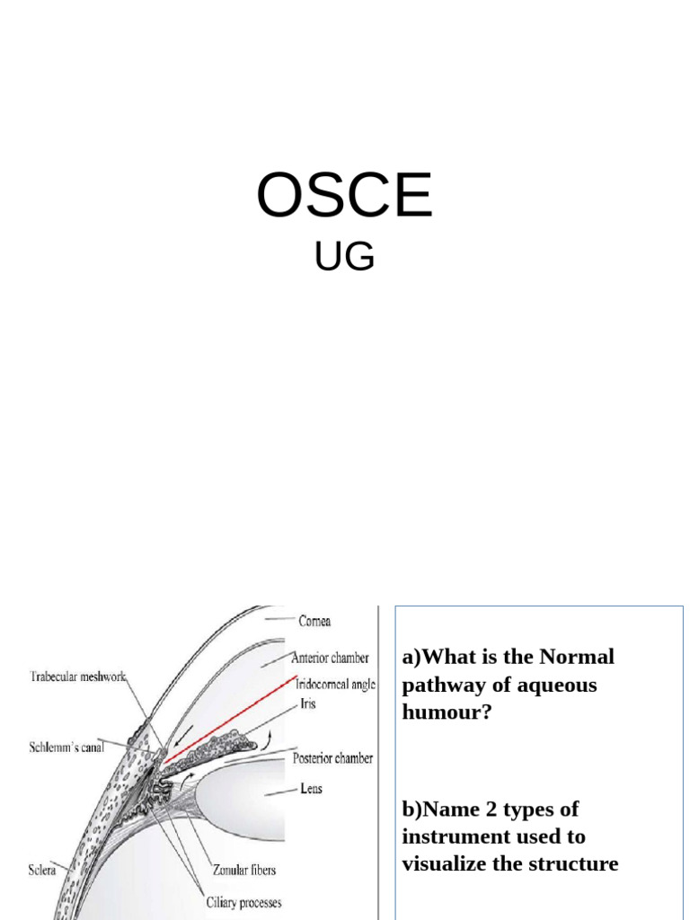 Comprehensive Guide to Ocular Anatomy and Conditions | PDF | Eye ...