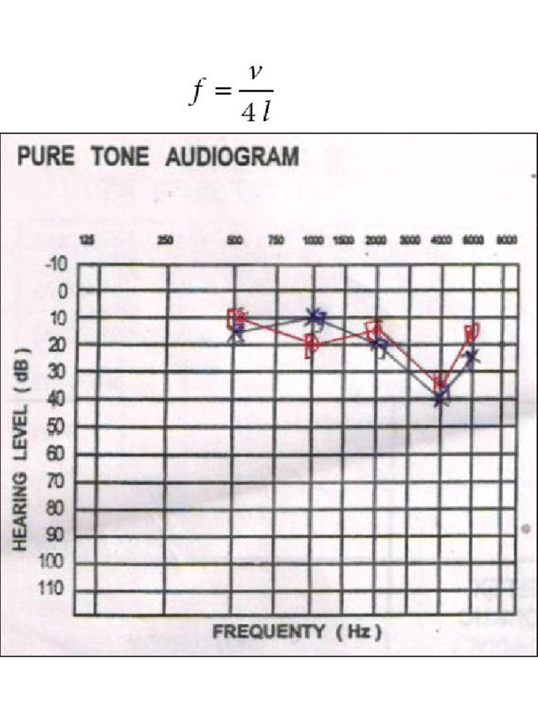 Audiometry ENT Practicals | PDF