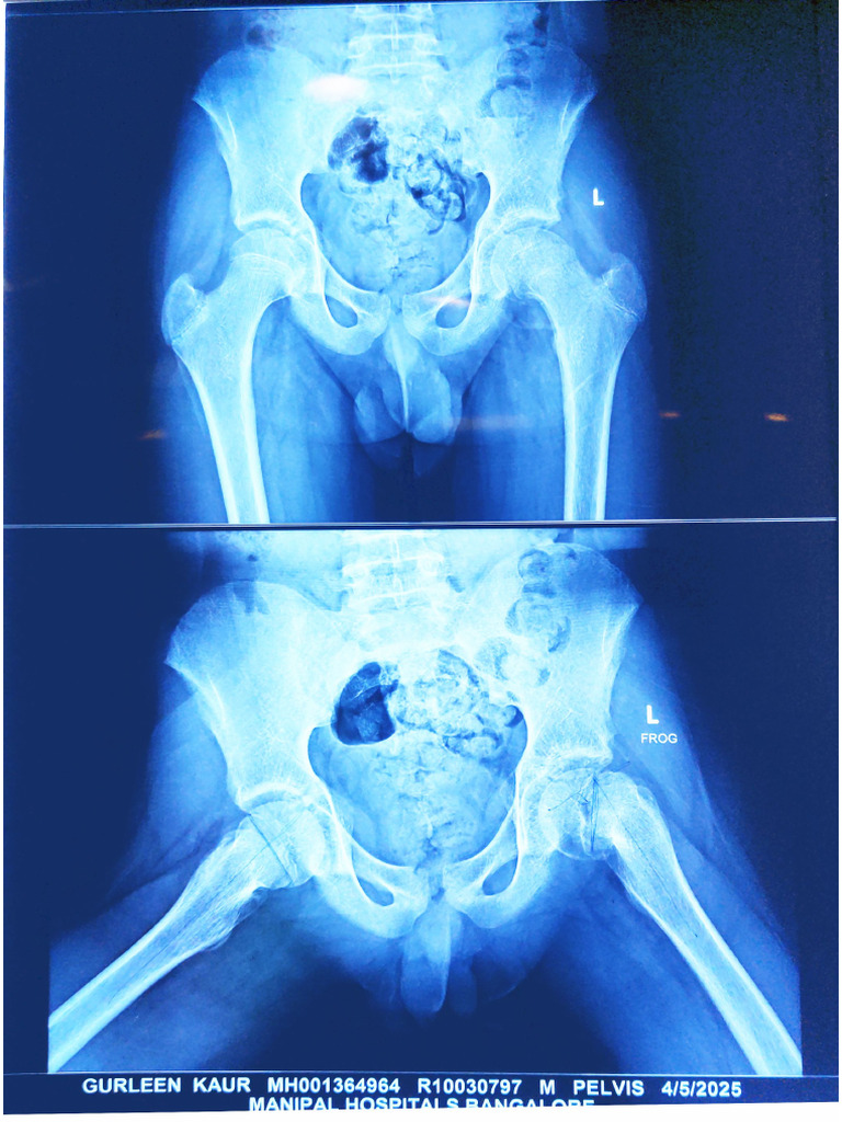 Xray | PDF