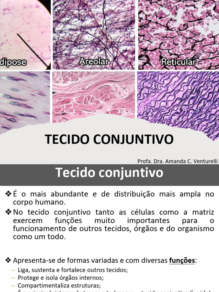 Classificação do Tecido Conjuntivo | PDF | Tecido conjuntivo | Matriz ...