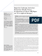 Superior Labrum Anterior-Posterior (SLAP) Tears: Evaluation of Three MR Signs On T2-Weighted Images