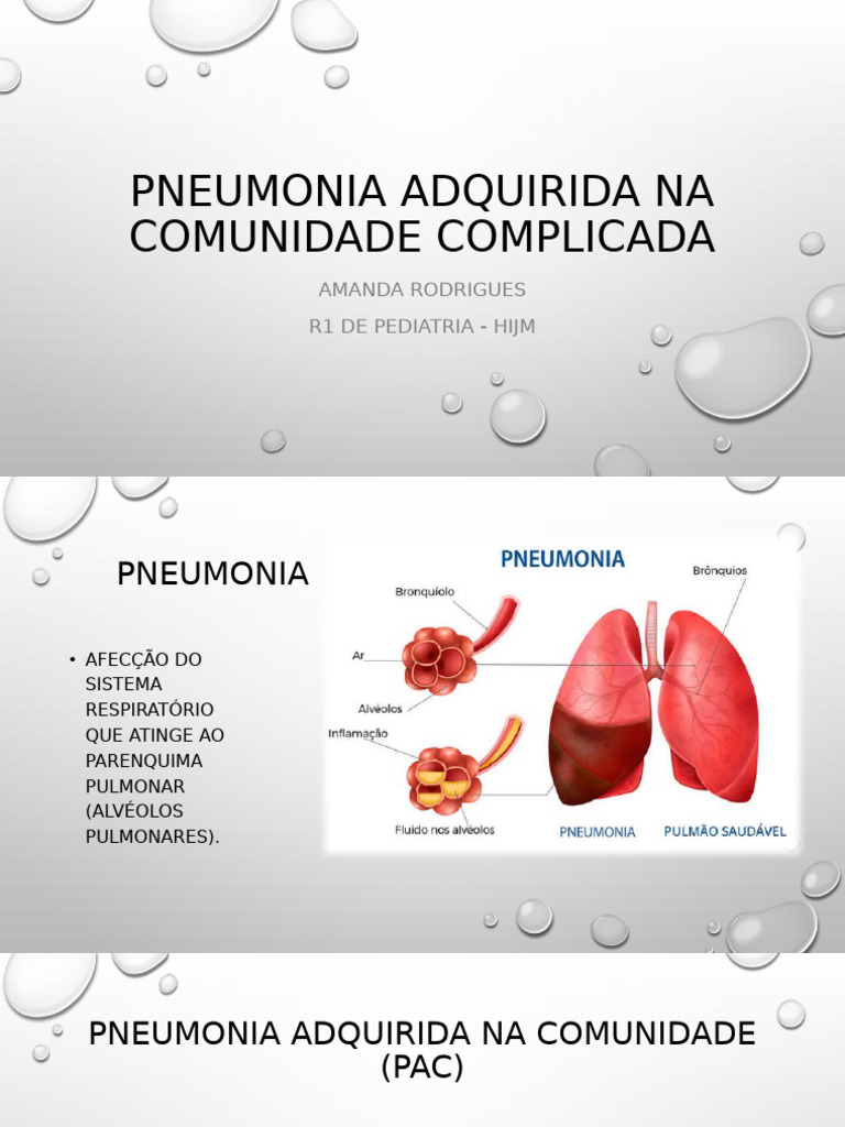Pneumonia Adquirida Na Comunidade Complicada | PDF | Pneumonia ...