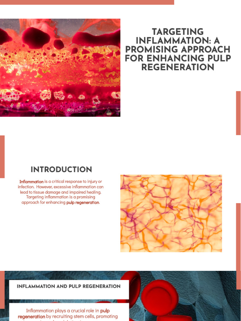 Enhancing Pulp Regeneration via Inflammation | PDF