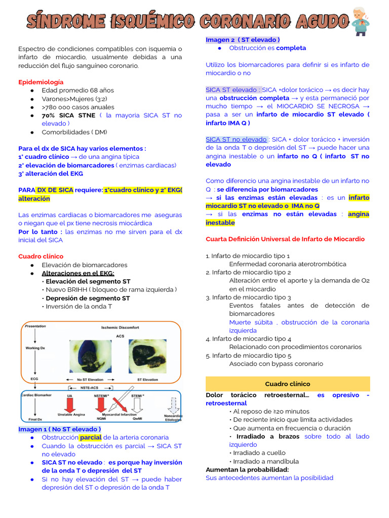 Sica | PDF | Infarto de miocardio | Medicina
