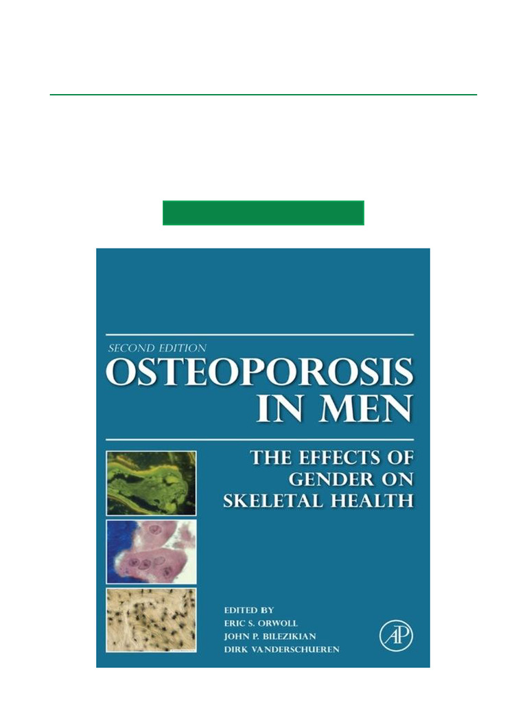 Osteoporosis in Men The Effects of Gender On Skeletal Health - 2nd ...