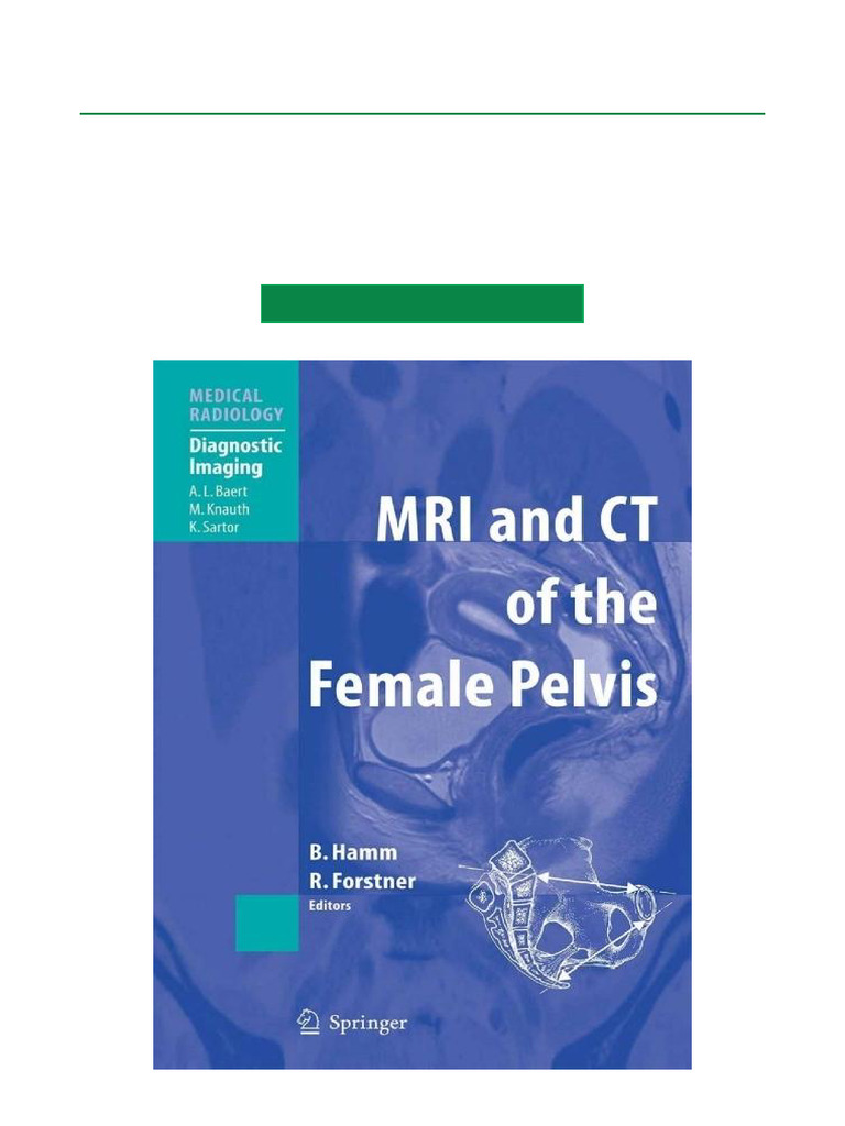 MRI and CT of The Female Pelvis 1st Edition Entire Book Download | PDF