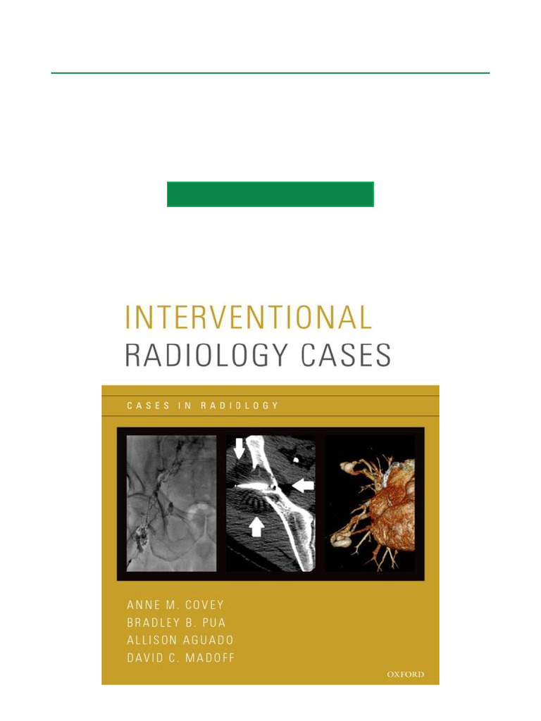 Interventional Radiology Case Studies | PDF | Vein | Cardiovascular System