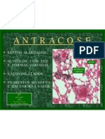 ANTRACOSE1-Alunos-2007